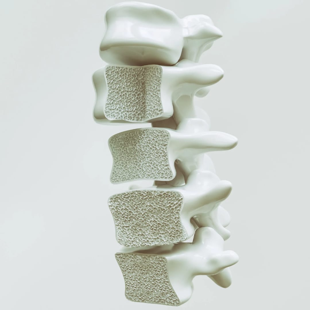 Osteoporosis Treatment in Bengaluru- Facts by Dr. Akshay Shetty
