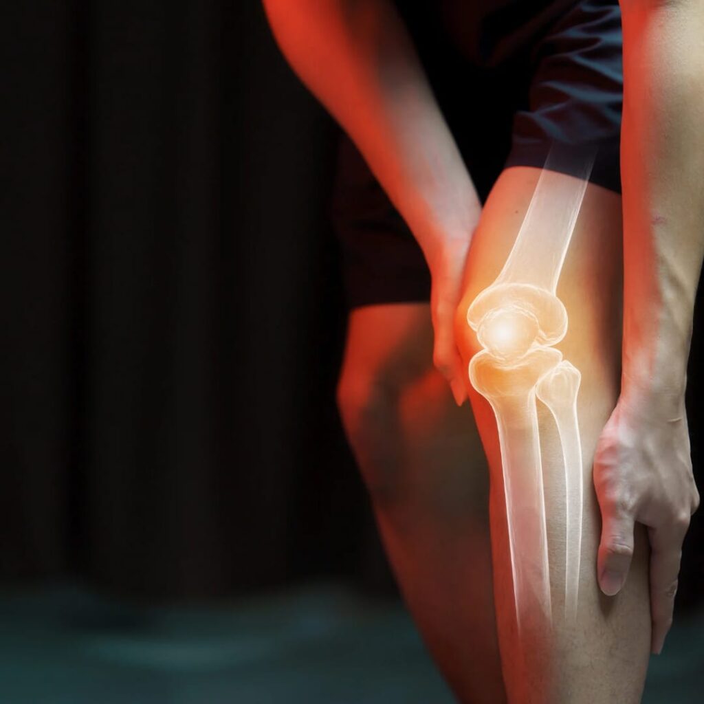 Orthopedic Bones
