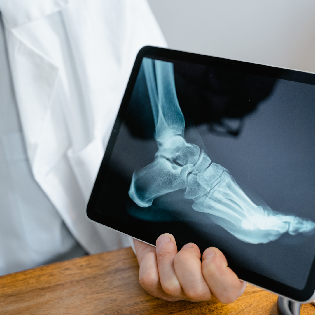 Finding the Best Bone Doctor Near Me: Your Guide to Expert Orthopaedic Care by Dr. Akshay Shetty  