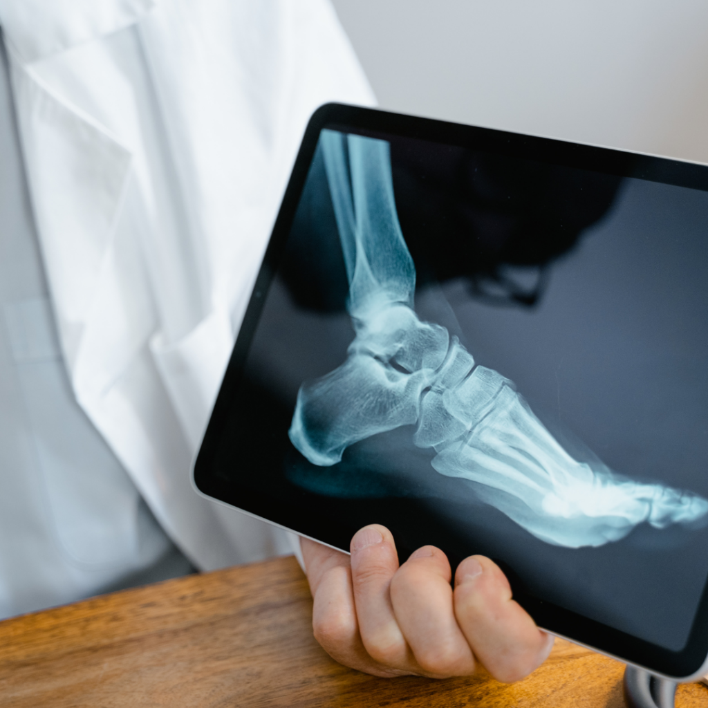 bone doctor Bangalore 