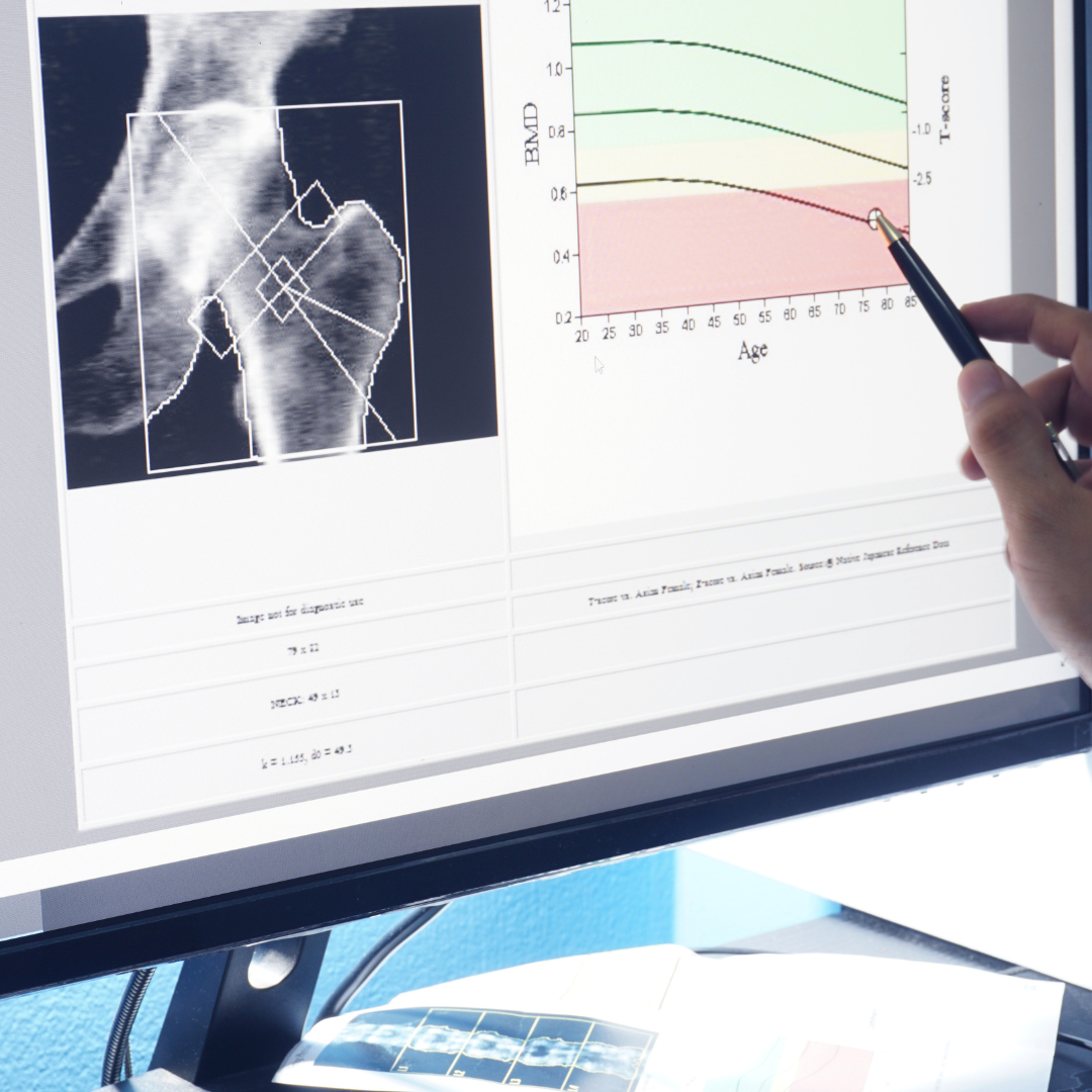 Bone Doctor bangalor checking bone density