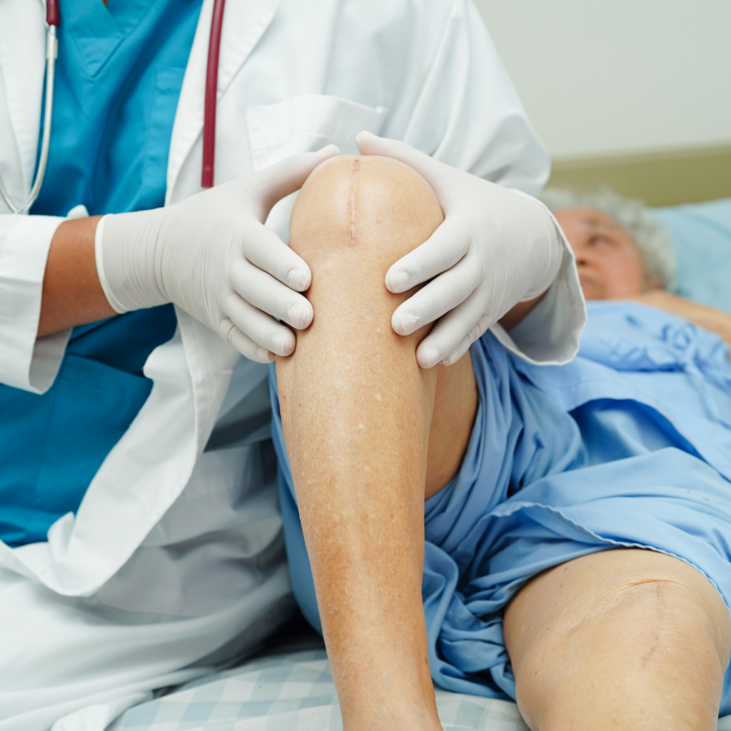 Knee Replacement May Be Needed